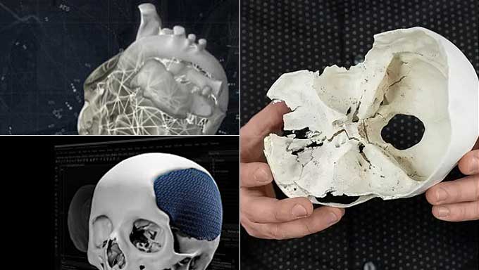 La UNAJ Recibió Financiamiento Para Diseñar Y Crear Piezas En 3D De Uso Hospitalario