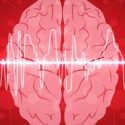 Diplomatura Superior En Neurofisiología Clínica: Electroencefalografía Y Video–Electroencefalografía. Modalidad Virtual