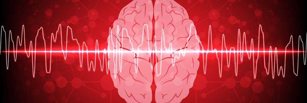 Diplomatura Superior en Neurofisiología Clínica: Electroencefalografía y Video–Electroencefalografía. Modalidad Virtual