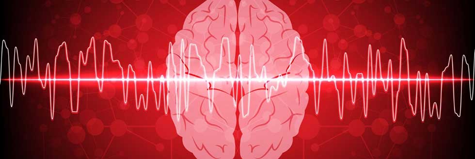 Diplomatura Superior En Neurofisiología Clínica: Electroencefalografía Y Video–Electroencefalografía. Modalidad Virtual
