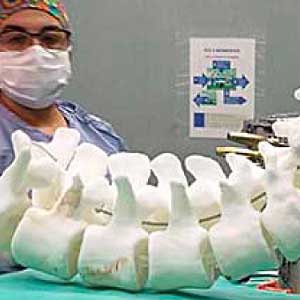 Desarrollo de un biomodelo mediante impresión 3D aplicado a cirugía de alta complejidad